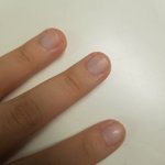 <b>손톱</b>이 너무 못생겼음