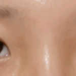 [이것좀봐줘] <b>짝눈</b> 심해?? 신경 쓰여서 미칠 것 같아