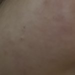 피부 이런거 어케 없애 ㅠㅠ