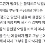 블랙<b>헤드</b> 없애는 방법 나 효과 봤음
