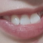 내 <b>앞니</b> ㅈㄴ 크다