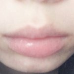 턱짧고 <b>인중</b>길어서 슬프다