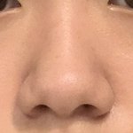 <b>코</b>성형 하는게 낫겠지?? 좀 봐줘
