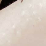 나 <b>불주사</b> 자국 아직 있음