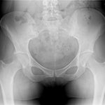 여자<b>x</b>-ray 나만 재밌음??