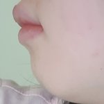 [댓글부탁해] 나 턱 무턱<b>심해</b>?