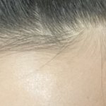 나 <b>탈모</b>냐