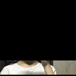 승모근 많은 편<b>아야</b>??ㅠ