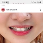 너네 <b>투스</b>젬 어케 생각함