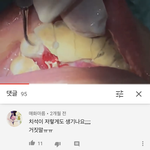와 <b>치석</b>이 이렇게 생기네 ㅈㄴ 신기하다