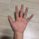 얘들아 나 손커? 마른거 <b>콤플렉스</b>일때 어떻게 해