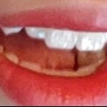[댓글부탁해] 내 <b>덧니</b> 어때