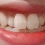 [댓글부탁해] 내 <b>덧니</b> ㅇㄸ ㅊㅂ