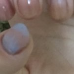 나 <b>엄지</b>우렁손톱?? 그건데