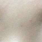 애들아 너희도 <b>미간</b> 오돌토돌 튀어나와있음??