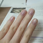 <b>손톱</b> 파래졌다