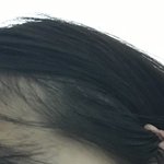 머리를 <b>귀뒤</b>로 넘길 수 없는이유