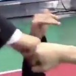 [댓글부탁해] <b>좁쌀</b>여드름 꿀팁 좀 알려주라제발ㅜ