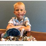 맹견 앞 여동생 구하고 머리 다친 美 소년…‘캡틴 아메리카’ 방패...