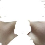 얘들아 나 <b>팔자</b>주름 봐바 ㅎㅎ 교정하고 인생 망했어
