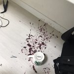 아ㅆㅂ <b>포도즙</b>다쏟음