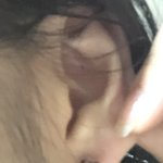 귓볼 피어싱 ㅜㅜ 언제 바꿔 ㅜ <b>투명</b>귀걸이에 묻은 피때문에