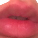 [댓글부탁해] 초간딴! 큐티<b>쁘띠</b> 입술필러 맞은 입술 되긩!