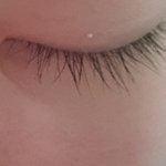 <b>눈</b>에 <b>이</b> 하얀거 뭘거 같냐