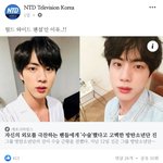 괘북 기사 제목 방탄 진 수술 고백 이카네