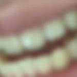 씹극혐주의) 나 이 진짜 누럼