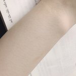 [19] <b>팔</b><b>털</b> 이런거 어케 없앰;ㅈㅂ