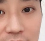 [이것좀봐줘] 30대 코성형 이정도면 성공한거임?