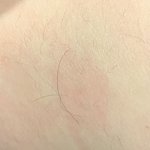 다리에 털 조카 길게 남