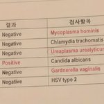[방탈죄송] 성병 잘 아시는 분...(남자친구 의심)