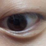 쌍수고민 고1 여자야
