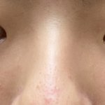 [댓글부탁해] 코 <b>평가</b>좀