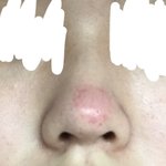 [댓글부탁해] 블랙<b>헤드</b> 오지는데