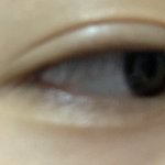 나 쌍수한 것 같아?