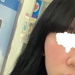 옆광대 심한 사람 있냐