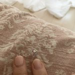 손젤 받았는데 이런경우 <b>리터치</b> 되나요?