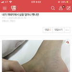 [드루와] 와내리즈시절