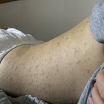 (추가)(추가) 내 몸이 썩어갑니다..