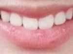 나 웃을때 <b>입이</b> 이상함