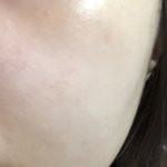 <b>피부</b> 이<b>정도</b>면 좋은편임??