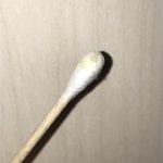 나 <b>각막</b>녹았다는 쓰닌데