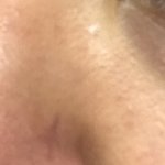 [댓글부탁해] 얘들아 내 <b>코옆</b>에 이 선뭐야??ㅠㅠ