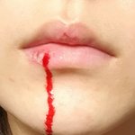 ㅁ친거아니야  (+ 본진에 대해 .........