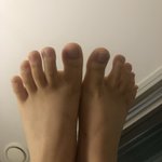 얘들아 내 <b>발가락</b> 징그러워??