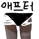 [톡톡] 병원에서 지방흡입수술 뒤통수 맞은 썰 (2년 뒤)