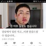 [이것좀봐줘] <b>송대익</b> 추성훈한테 맞았다고 구라친다ㅋㅋㅋ